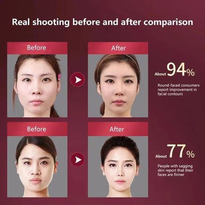 LED V-Line Face Lifting Massager