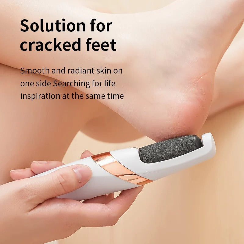 Electric Foot File Callus Remover